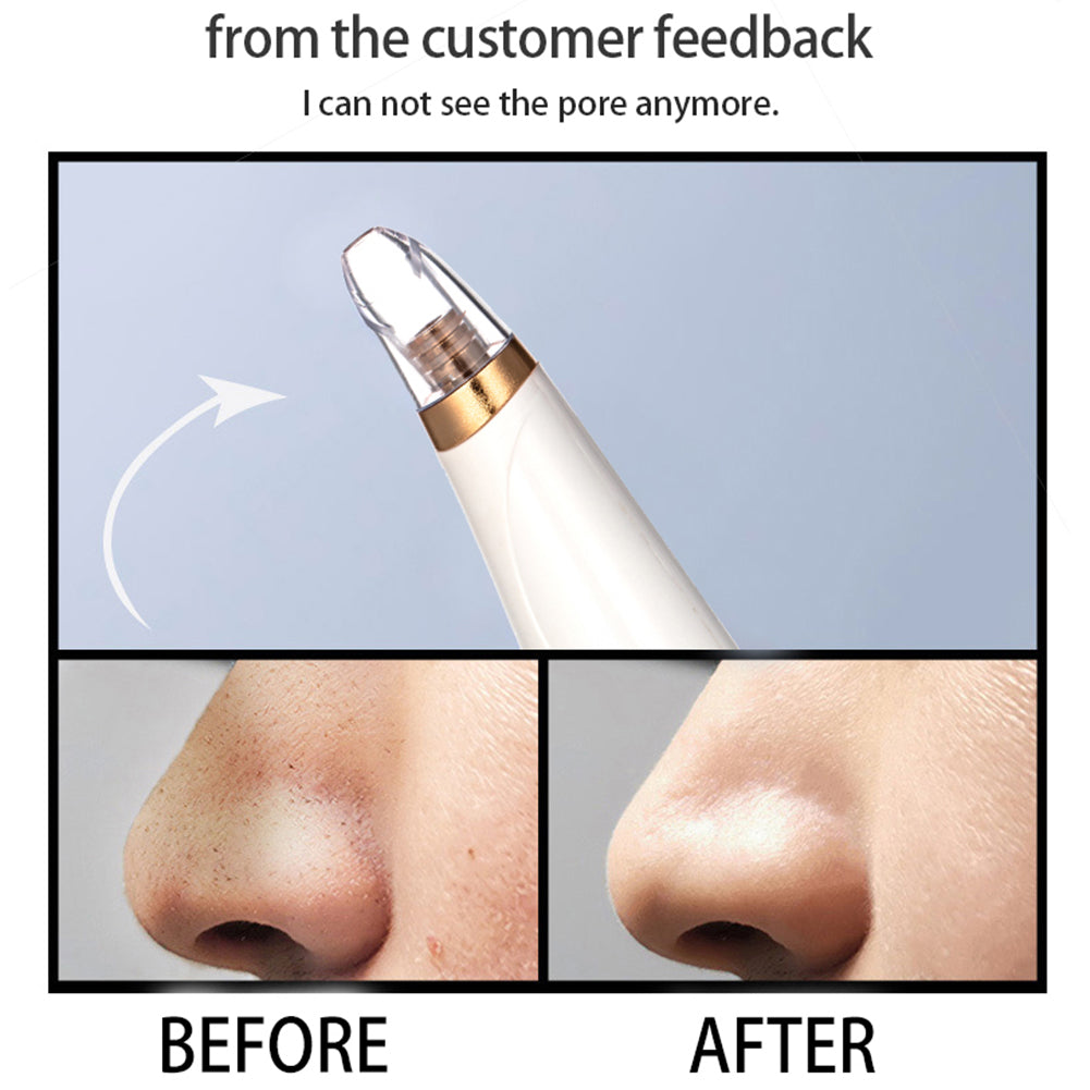 LIMPIADOR FACIAL PROFESIONAL